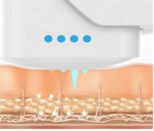 Hifu ハイフ の小顔効果は何日後がベスト Meshie銀座エステサロン ハイフ ハーブピーリング専門店